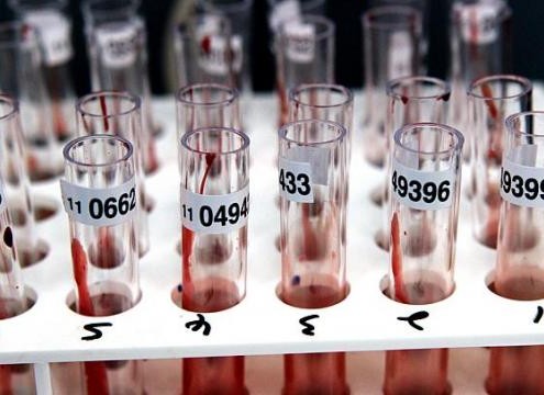 The number of homosexual and bisexual cases has risen from 166 in 2009 to 247 last year. Action for Aids says the rise could be due to the availability of effective anti-retroviral medication and a degree of "condom fatigue" in Singapore. -- ST FILE PHOTO - See more at: http://www.straitstimes.com/news/singapore/health/story/worrying-rise-hiv-cases-among-gay-men-20140605#sthash.jGH56AcL.dpuf